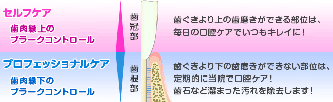 予防歯科の基本。セルフケアとプロフェッショナルケア