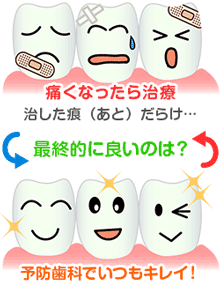 永久歯の抜歯原因調査。虫歯が原因で歯を失った方は30%を超えています！