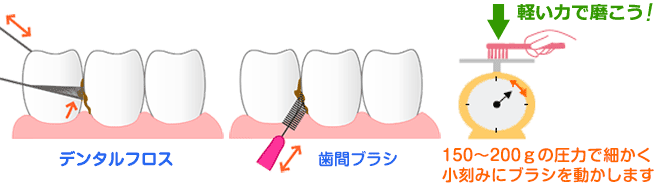 歯磨き方法の説明の基本。セルフケアとプロフェッショナルケア