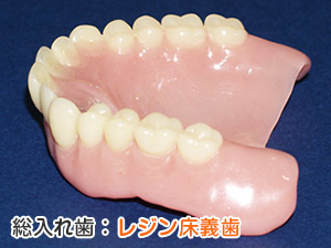 総入れ歯：レジン床義歯 