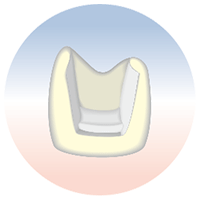 セレックオールセラミックス修復：臼歯部インレー（奥歯のつめ物）
