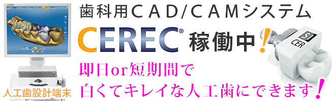 セレックなら下のような【すきっ歯】でも、短時間、お手頃価格で、体にやさしいセラミックスの人工歯にできます！