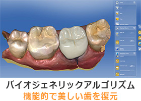 バイオジェネリックアルゴリズムが機能的で美しい歯を復元