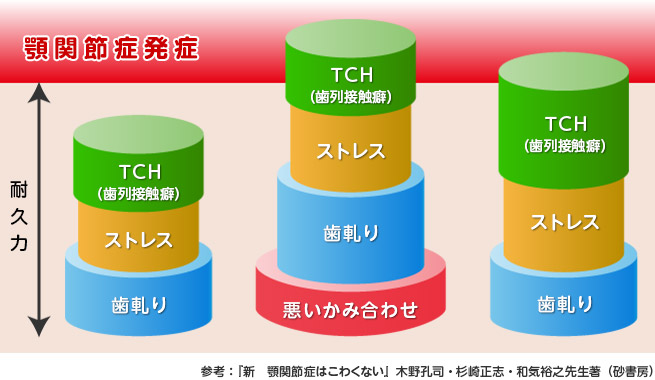 TCH（歯列接触癖）と歯軋り（ブラキシズム）が要因の顎関節症