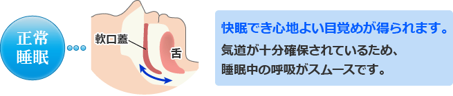 正常睡眠時の呼吸