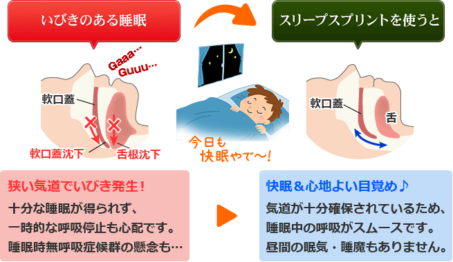 スリープスプリントを使用すると